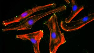 Molecular Neuroscience