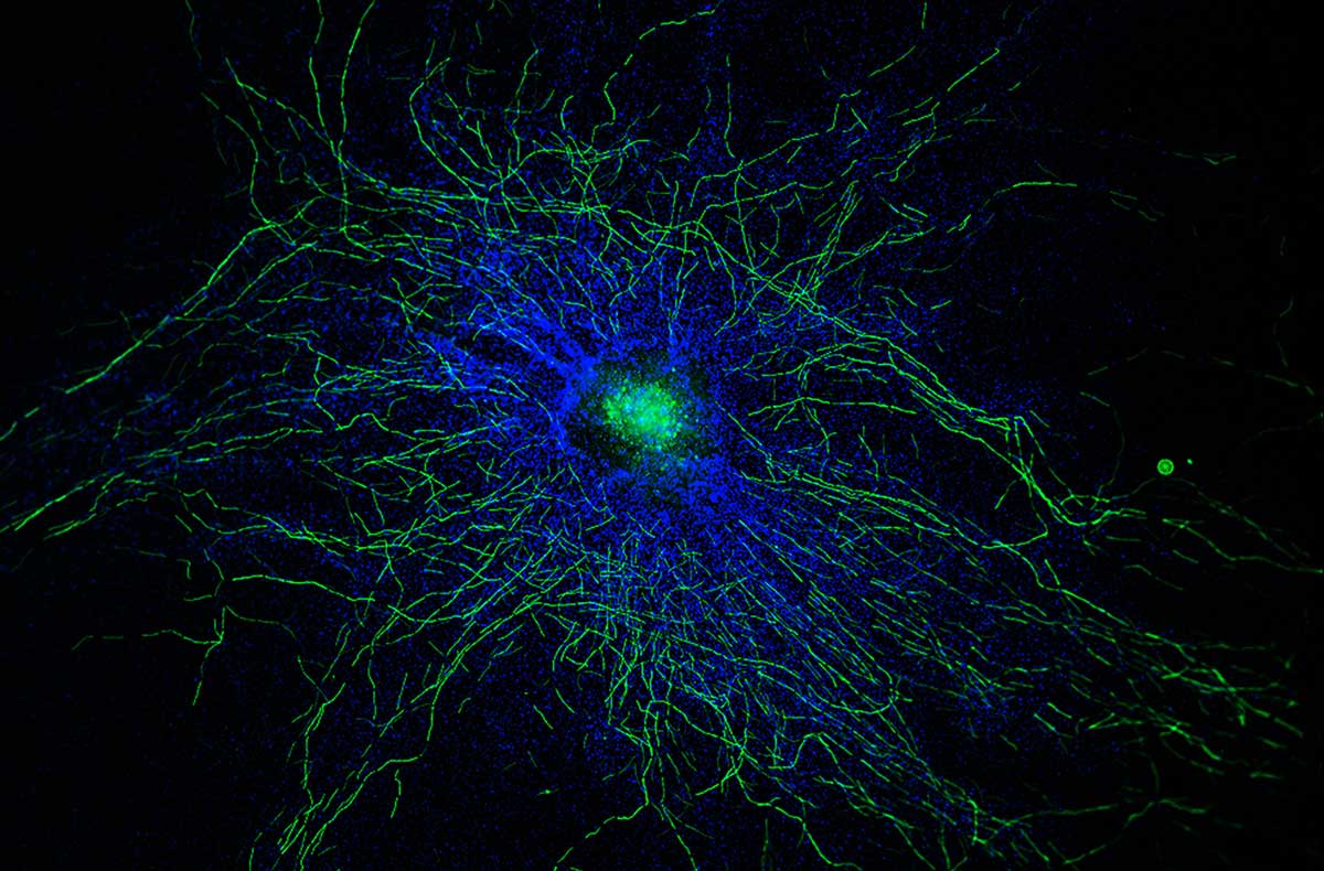 labs - Brown Neurosurgery